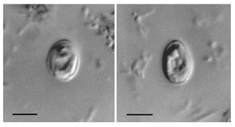 Cryptosporidium muris. Credit: public domain image